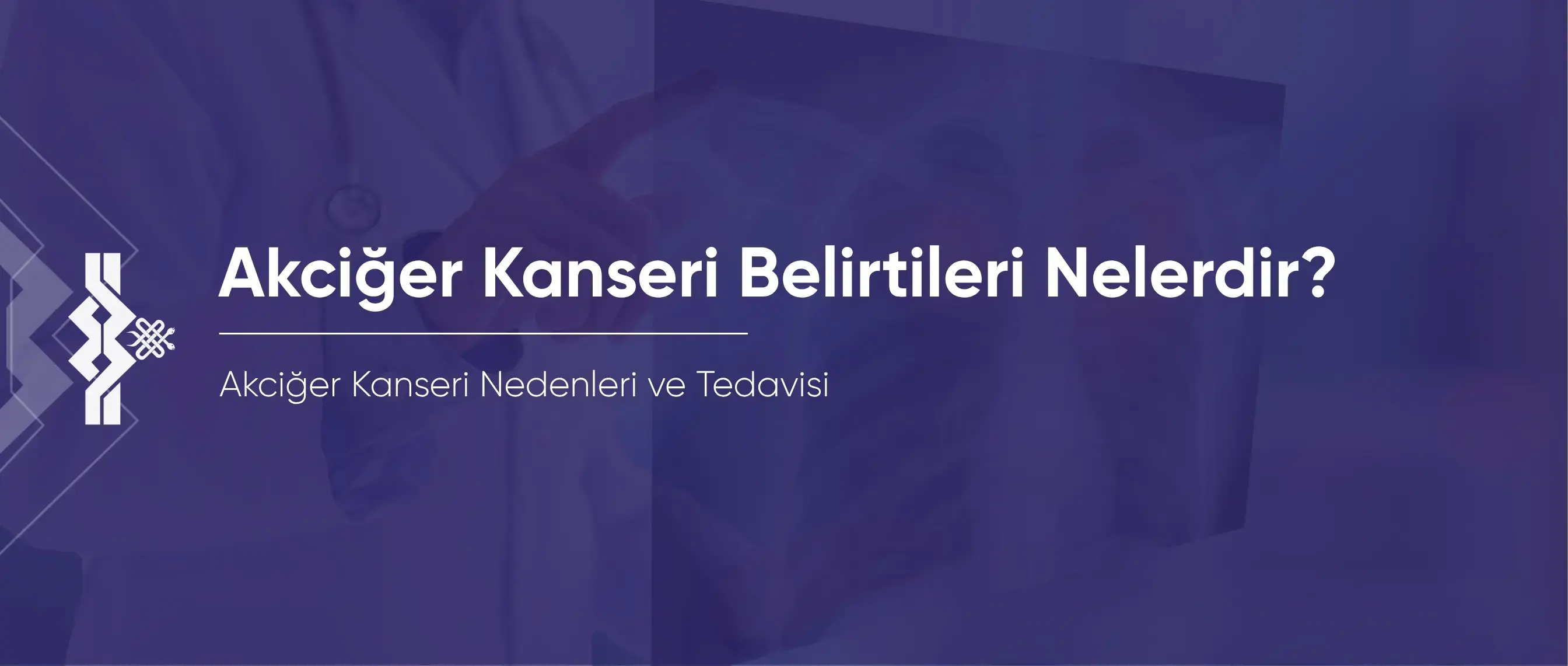 Akciğer Kanseri Belirtileri Nelerdir? Nedenleri ve Tedavisi