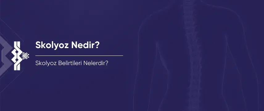 Skolyoz Nedir? Skolyoz Belirtileri