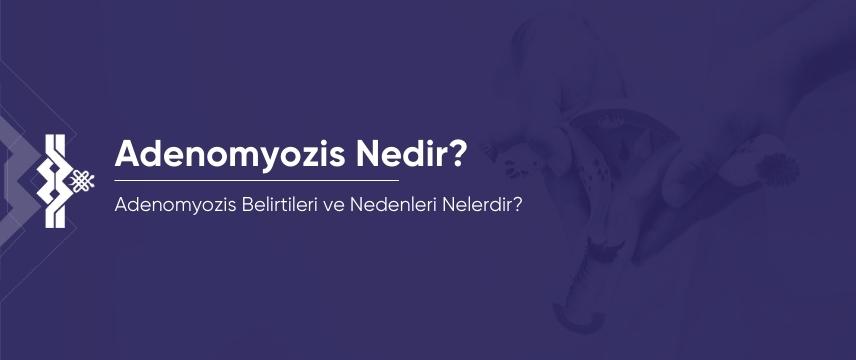 Adenomyozis Nedir? Belirtileri ve Nedenleri Nelerdir?