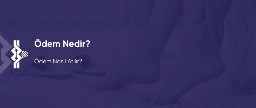 Ödem Nedir? Ödem Nasıl Atılır?
