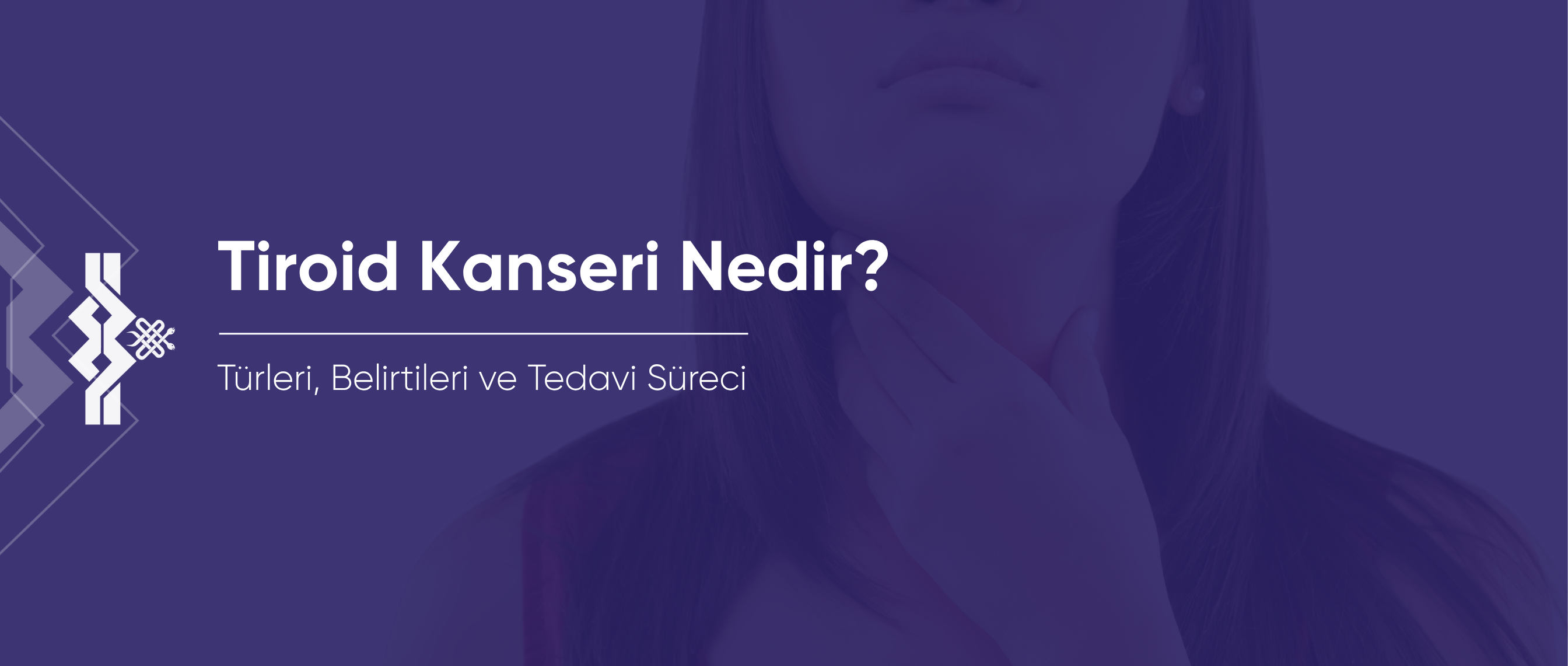 Tiroid Kanseri Nedir? Türleri, Belirtileri ve Tedavi Yöntemleri