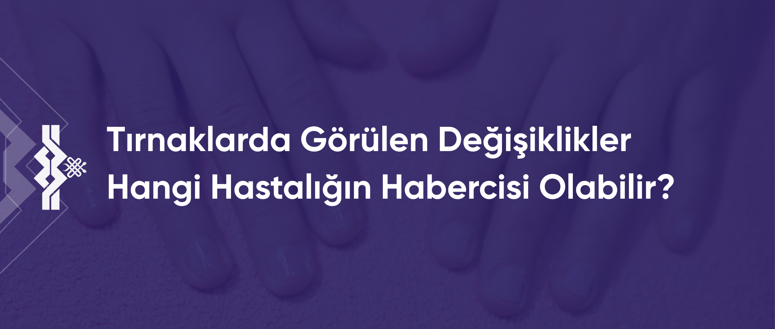 Tırnaklarda Görülen Değişiklikler Hangi Hastalıkların Habercisi Olabilir?